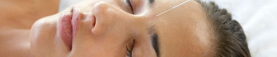 Acupuncture for anxiety - Shine Health Wellbeing Centre